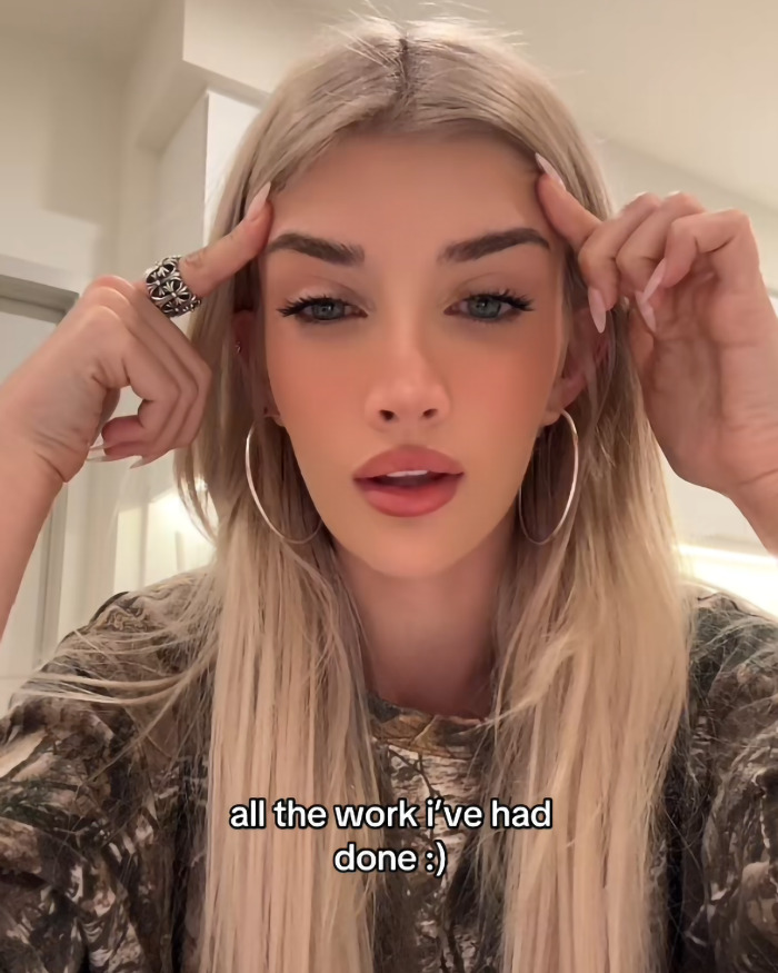 Blonde woman with hoop earrings discusses cosmetic surgeries, pointing at her temples in a camo shirt. Blonde woman with hoop earrings discusses cosmetic surgeries, pointing at her temples in a camo shirt.