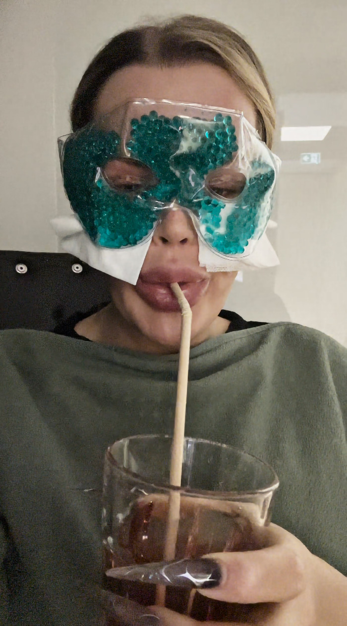 YouTube influencer after eyelid surgery, wearing a cooling mask and sipping a drink through a straw. YouTube influencer after eyelid surgery, wearing a cooling mask and sipping a drink through a straw.