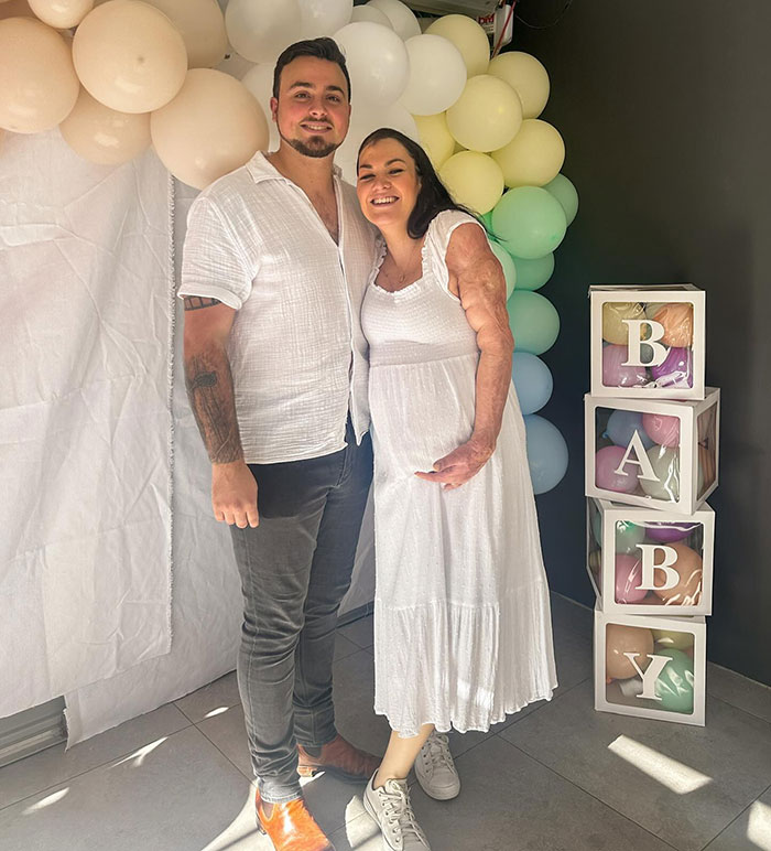 Miracle burns survivor in a white dress, smiling with partner during a celebratory event with balloons and baby blocks. Miracle burns survivor in a white dress, smiling with partner during a celebratory event with balloons and baby blocks.