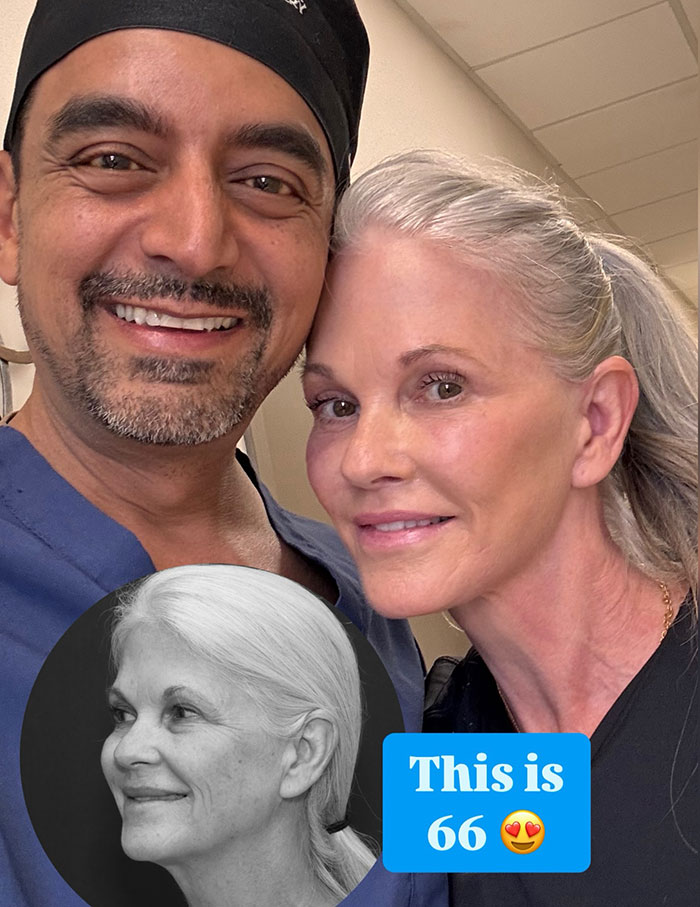 Smiling woman post-plastic surgery with surgeon, showcasing transformation at 66 after cosmetic procedures. Smiling woman post-plastic surgery with surgeon, showcasing transformation at 66 after cosmetic procedures.