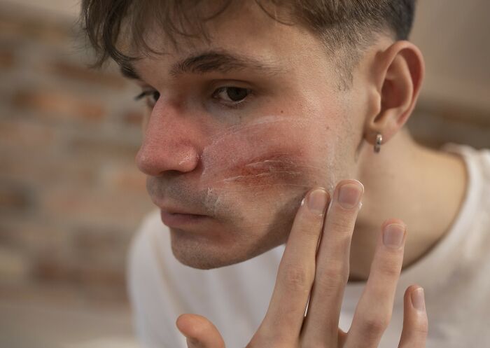 Person examines their face with a concerned expression, focusing on a mark on their cheek.
