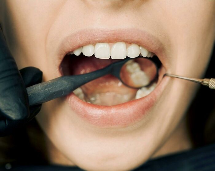 Close-up of dental tools examining a patient’s mouth, highlighting unexplainable pain people endure during checkups