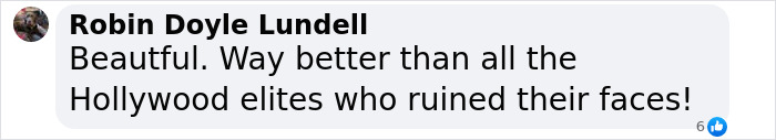 Comment praising successful plastic surgery transformation over Hollywood elites. Comment praising successful plastic surgery transformation over Hollywood elites.