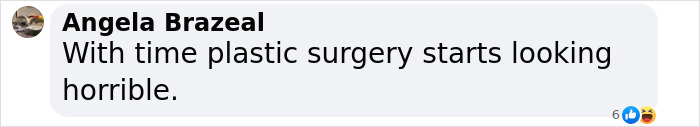 Comment on plastic surgery from Angela Brazeal expressing skepticism about long-term results. Comment on plastic surgery from Angela Brazeal expressing skepticism about long-term results.