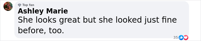 Comment by Ashley Marie on plastic surgery results: "She looks great but she looked just fine before, too. Comment by Ashley Marie on plastic surgery results: "She looks great but she looked just fine before, too.