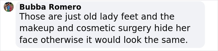 Comment discussing Ozempic feet and cosmetic surgery effects. Comment discussing Ozempic feet and cosmetic surgery effects.