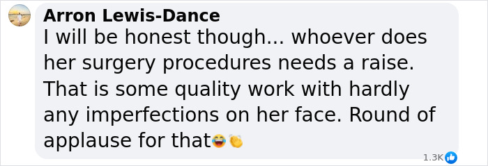 Comment joking about Sharon Osbourne's appearance and surgery, highlighting flawless results. Comment joking about Sharon Osbourne's appearance and surgery, highlighting flawless results.