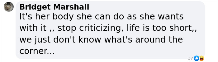 Comment defending Sharon Osbourne, urging against criticism for using photo filters. Comment defending Sharon Osbourne, urging against criticism for using photo filters.