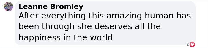 Comment praising a burns survivor and wishing her happiness. Comment praising a burns survivor and wishing her happiness.