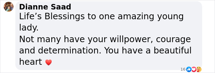 Message praising a burns survivor's courage and beautiful heart after sharing wedding moments. Message praising a burns survivor's courage and beautiful heart after sharing wedding moments.