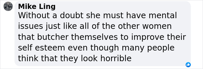 Screenshot of a social media comment discussing K-Pop star's drastic transformation amid surgery rumors. Screenshot of a social media comment discussing K-Pop star's drastic transformation amid surgery rumors.