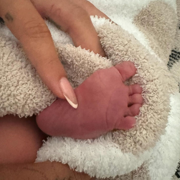 Baby Jack's foot wrapped in a towel by the pool, sparking internet debate around privacy. Baby Jack's foot wrapped in a towel by the pool, sparking internet debate around privacy.