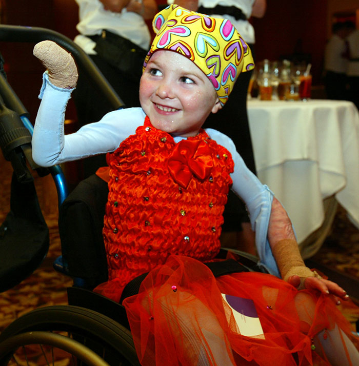 Miracle burns survivor in vibrant dress and colorful headscarf, smiling and sitting in a wheelchair during a festive event. Miracle burns survivor in vibrant dress and colorful headscarf, smiling and sitting in a wheelchair during a festive event.