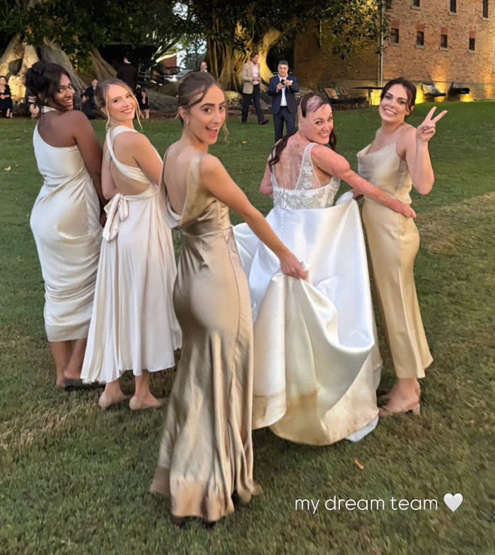Wedding weekend with miracle burns survivor and bridesmaids outdoors, smiling and posing in elegant dresses. Wedding weekend with miracle burns survivor and bridesmaids outdoors, smiling and posing in elegant dresses.