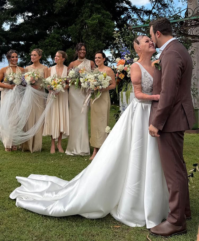 Miracle burns survivor at wedding, wearing a white gown, smiling with partner, surrounded by bridesmaids with bouquets. Miracle burns survivor at wedding, wearing a white gown, smiling with partner, surrounded by bridesmaids with bouquets.