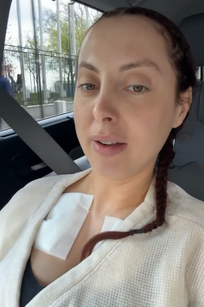 Woman with braided hair in a car, wearing a white top post-plastic surgery on her chest. Woman with braided hair in a car, wearing a white top post-plastic surgery on her chest.