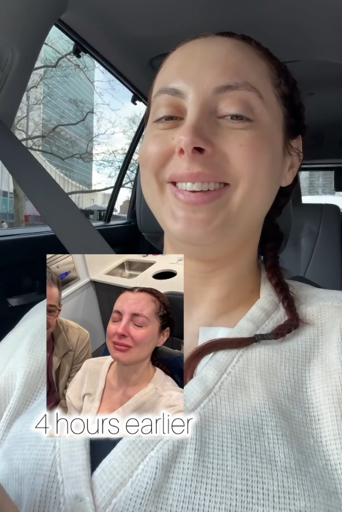 Woman after plastic surgery, smiling in a car with inset past image showing emotion post-procedure. Woman after plastic surgery, smiling in a car with inset past image showing emotion post-procedure.