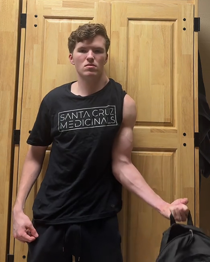 Young man, dubbed "The Crooked Man," showing asymmetrical muscle growth from working out only one side, stands confidently. Young man, dubbed "The Crooked Man," showing asymmetrical muscle growth from working out only one side, stands confidently.