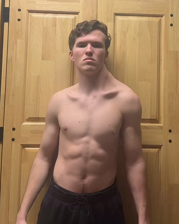 19-year-old known as "The Crooked Man" shows off asymmetrical physique, focusing on one-sided workouts. 19-year-old known as "The Crooked Man" shows off asymmetrical physique, focusing on one-sided workouts.