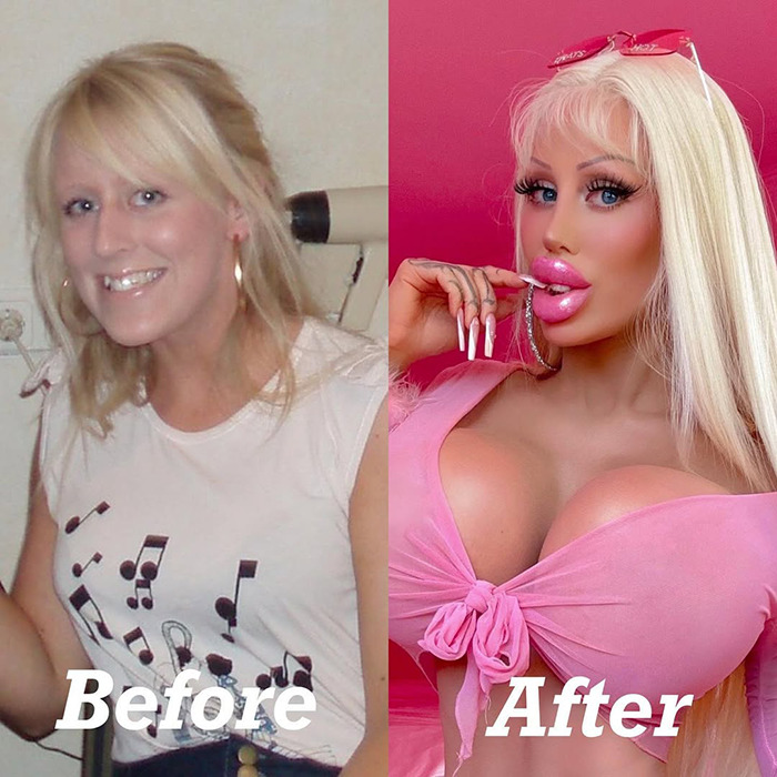 Woman's transformation into Barbie after $120k makeover, showcasing before and after images. Woman's transformation into Barbie after $120k makeover, showcasing before and after images.