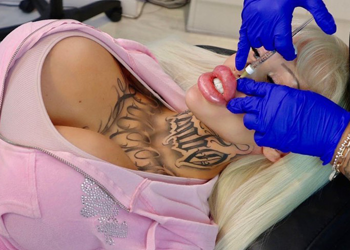 Woman undergoing cosmetic procedure to look like Barbie, getting injection by a professional in gloves. Woman undergoing cosmetic procedure to look like Barbie, getting injection by a professional in gloves.