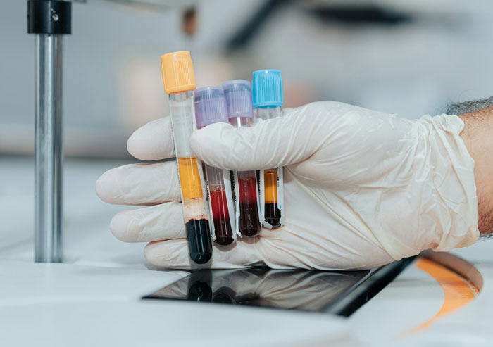 Gloved hand holding blood sample vials, relating to secrets spouses may keep after marriage in medical context.