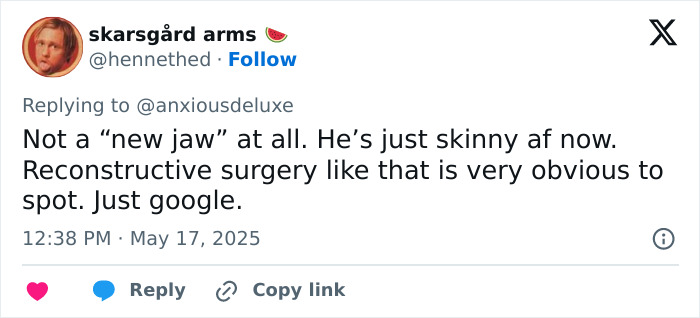 Tweet discussing Pedro Pascal’s new jaw, debating if it’s due to plastic surgery or weight loss with Ozempic. Tweet discussing Pedro Pascal’s new jaw, debating if it’s due to plastic surgery or weight loss with Ozempic.