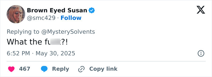 Elon Musk at White House with visible black eye and head tics, raising concerns about his recent glitching behavior Elon Musk at White House with visible black eye and head tics, raising concerns about his recent glitching behavior