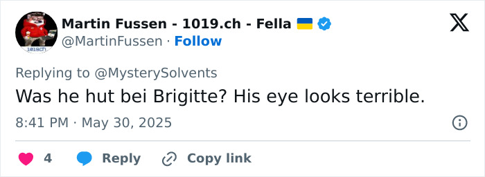 Tweet screenshot showing concern about Elon Musk’s black eye and head tics raising glitching worries at the White House. Tweet screenshot showing concern about Elon Musk’s black eye and head tics raising glitching worries at the White House.