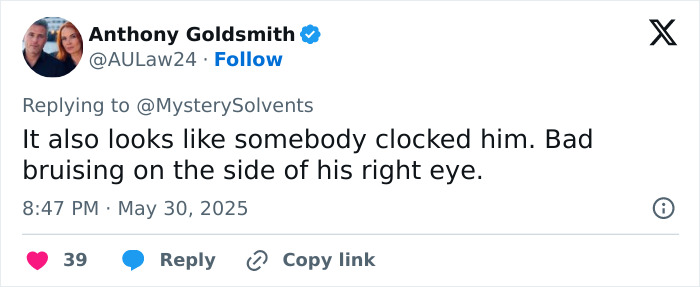 Tweet discussing concerns about Elon Musk's black eye and head tics after White House appearance, highlighting bruising near eye. Tweet discussing concerns about Elon Musk's black eye and head tics after White House appearance, highlighting bruising near eye.
