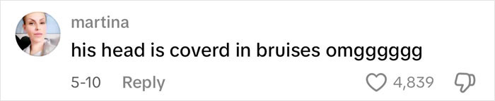 Comment on social media saying his head is covered in bruises, related to ET's Baby and Island Boy bullying incident. Comment on social media saying his head is covered in bruises, related to ET's Baby and Island Boy bullying incident.
