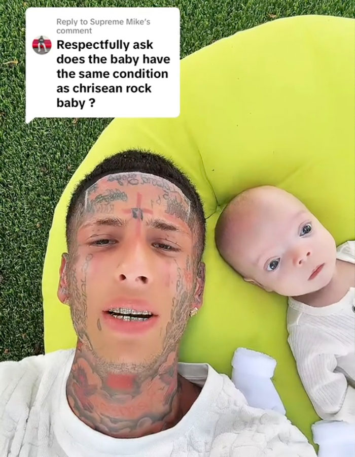 Island Boy lying on grass next to his baby, responding to fan questions about his baby's condition in a social media video. Island Boy lying on grass next to his baby, responding to fan questions about his baby's condition in a social media video.