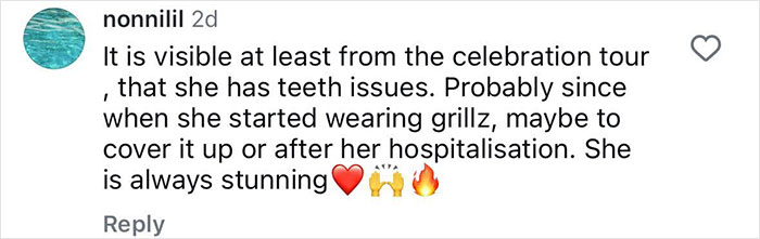 Social media comment discussing Madonna fans noticing a missing famous gap in her teeth and possible teeth issues. Social media comment discussing Madonna fans noticing a missing famous gap in her teeth and possible teeth issues.