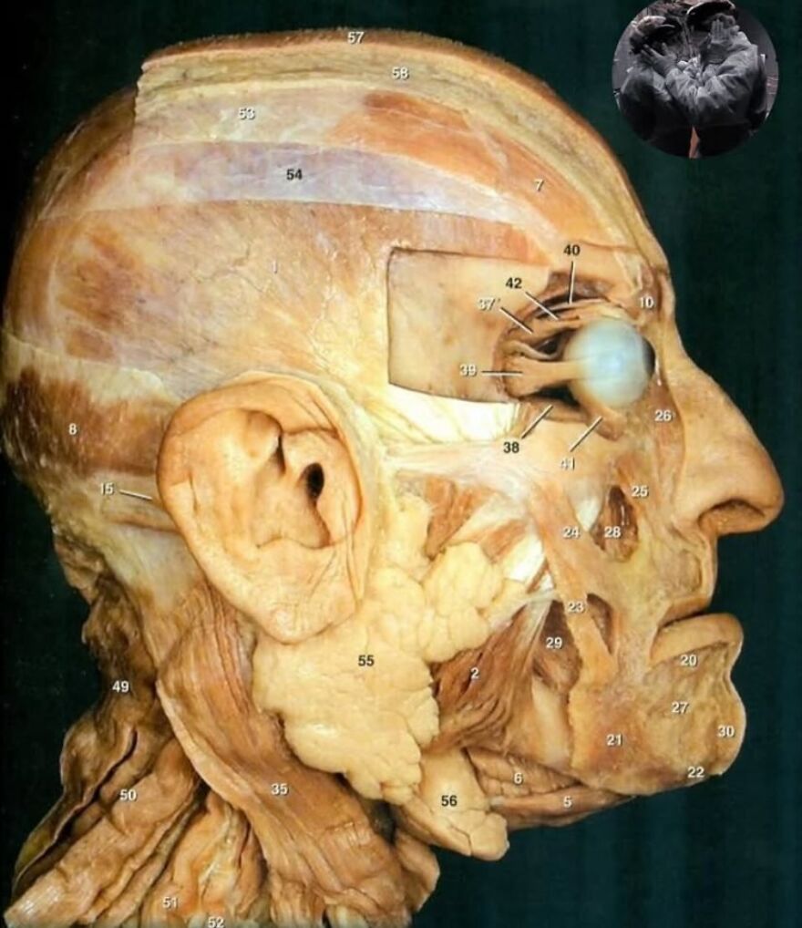Detailed anatomical side view of a dissected human head showing bizarre medical features and labeled parts.