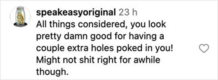 Screenshot of a social media comment responding to Pink's husband's graphic post surgery picture after bike accident recovery.