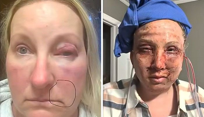 "I Look Worse Than When I Started": Before-And-After Results Of Botched Plastic Surgeries Stun "I Look Worse Than When I Started": Before-And-After Results Of Botched Plastic Surgeries Stun