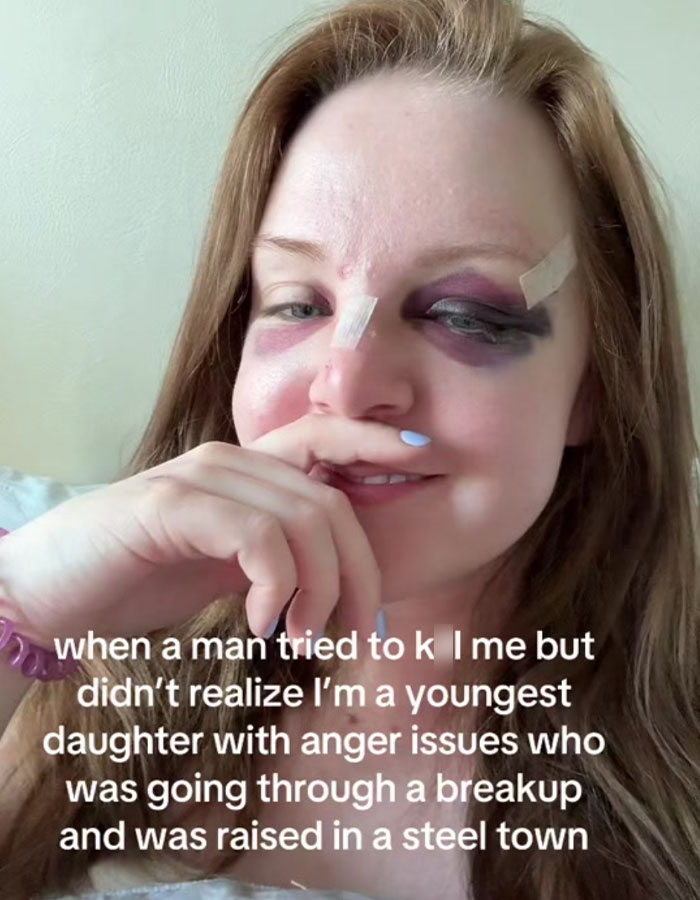 Woman with visible bruises and bandages sharing her survival story highlighting misogyny and gender-based violence awareness. Woman with visible bruises and bandages sharing her survival story highlighting misogyny and gender-based violence awareness.