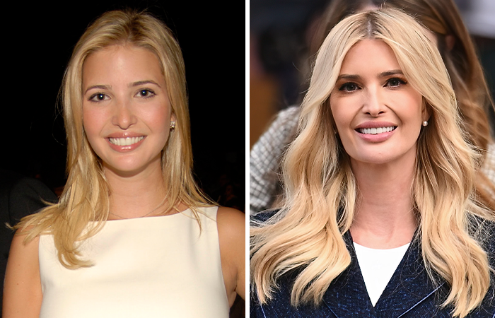 Side-by-side photos of Ivanka Trump showing changes linked to Mar-a-Lago face and plastic surgery insights. Side-by-side photos of Ivanka Trump showing changes linked to Mar-a-Lago face and plastic surgery insights.