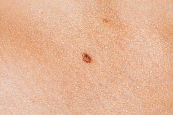 40 Times A “Just To Be Safe” Precaution Was The Only Thing Standing Between Life And Death