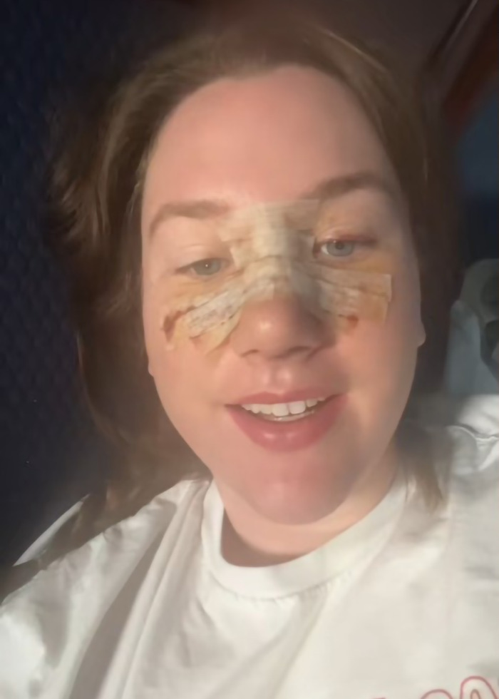 Young mom recovering from surgery with facial bandages, surprised by how many kids she gave birth to. Young mom recovering from surgery with facial bandages, surprised by how many kids she gave birth to.
