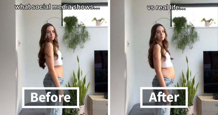 40 Women Tired Of “Skinny-Tok” Show What Unedited Bodies Look Like