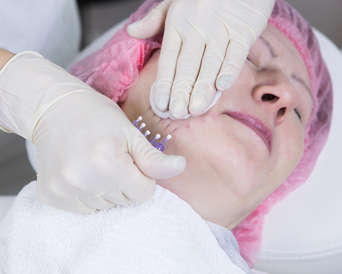 Woman receiving cosmetic injection treatment on her face from a plastic surgeon wearing white gloves and a pink hair cover. Woman receiving cosmetic injection treatment on her face from a plastic surgeon wearing white gloves and a pink hair cover.