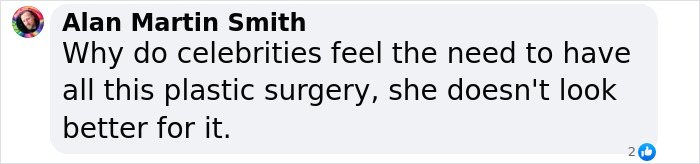 Comment from Alan Martin Smith questioning celebrities' plastic surgery, mentioning it doesn't improve appearance. Comment from Alan Martin Smith questioning celebrities' plastic surgery, mentioning it doesn't improve appearance.