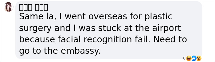 Passenger shares experience of facial recognition failure at airport after plastic surgery, causing travel delay. Passenger shares experience of facial recognition failure at airport after plastic surgery, causing travel delay.