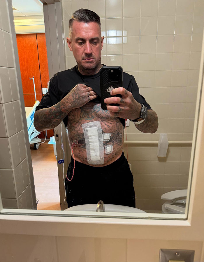 Pink's husband taking a hospital mirror selfie showing his post surgery torso with bandages after a bike accident.