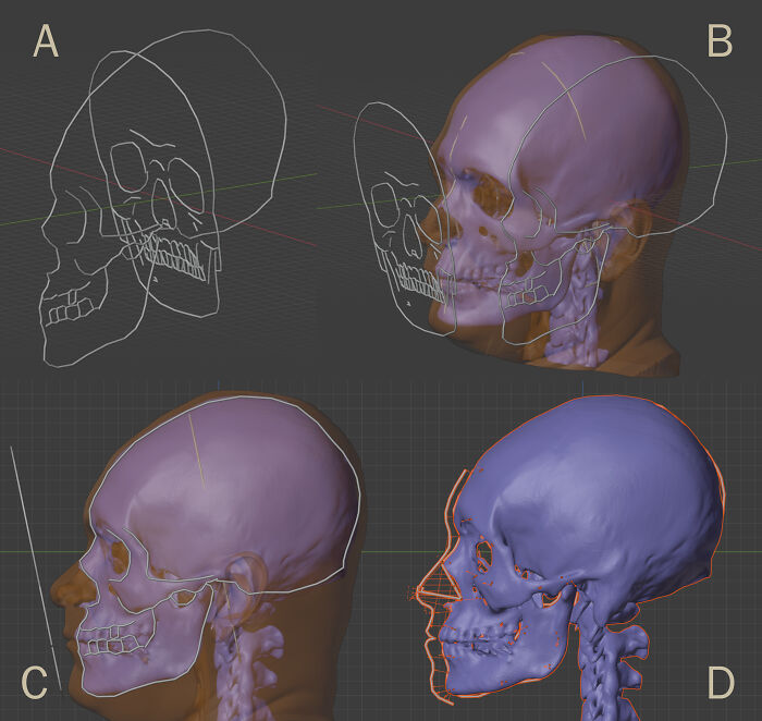 3D skull scans combined with facial reconstruction techniques to recreate Mozart, Bach, and Beethoven faces.