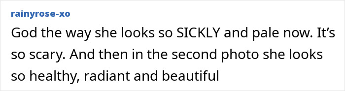 Ariana Grande with an entirely visible ribcage in a ghoulish look from the new Wicked trailer sparking worry. Ariana Grande with an entirely visible ribcage in a ghoulish look from the new Wicked trailer sparking worry.