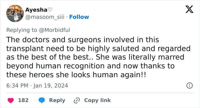 Tweet praising doctors and surgeons for a successful face transplant on a woman torn apart by a chimpanzee, restoring her appearance. Tweet praising doctors and surgeons for a successful face transplant on a woman torn apart by a chimpanzee, restoring her appearance.