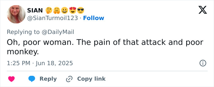 Tweet from a user expressing sorrow about a woman attacked by a chimpanzee, referencing the pain from the incident. Tweet from a user expressing sorrow about a woman attacked by a chimpanzee, referencing the pain from the incident.