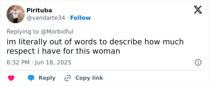 Woman revealing her appearance 16 years after face transplant following chimpanzee attack, showing recovery progress. Woman revealing her appearance 16 years after face transplant following chimpanzee attack, showing recovery progress.